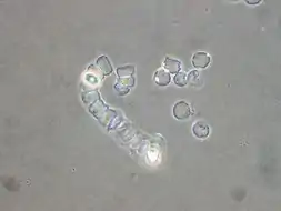 Agregados de Acrasis rosea (Acrasida)