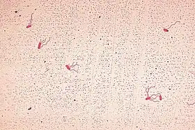 Alcaligenes xylosoxidans