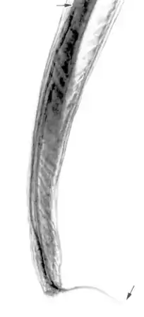 Angiostrongylus cantonensis