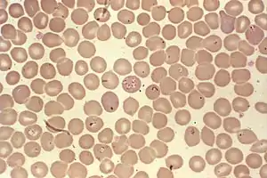 Babesia sp. infectando hemácias.