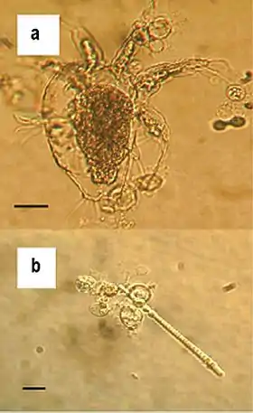 Zoosporangia de B. dendrobatidis crescendo em artrópodes de água doce (a) e algas (b); barras de escala = 30 µm