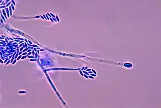 Fusarium verticillioides