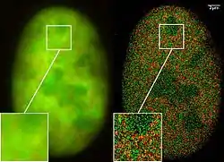 Microscopia de Super Resolução: Co-localização de microscopia (2CLM) com fusã de proeínas GFP e RFP  (núcleo de uma célula de câncer ósseo) 120&nbsp;000 moléculas localizadas em uma grande área (470&nbsp;µm²) medido com um microcóspio Vertico-SMI/SPDMphymod
