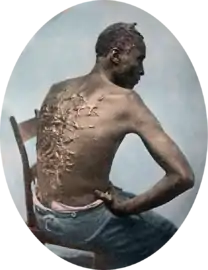 Antigo diapositivo colorido de Gordon durante seu exame médico de 1863 (com a imagem invertida da esquerda para a direita)