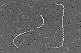 Leptospira interrogans por micrografia eletrônica