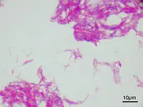 Mycobacterium bovis.