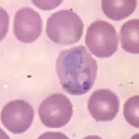 Plasmodium vivax