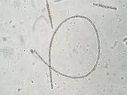 Planktothrix rubescens, uma espécie de Oscillatoriales.