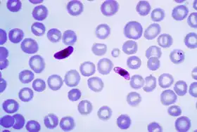 Plasmodium falciparum no sangue