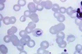 Trofozoíto de Plasmodium ovale