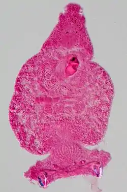 Pseudorhabdosynochus morrhua.