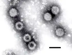 Rotavirus (Reoviridae)Escala = 100 ηm