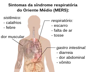 Diagrama de sintomas de MERS.
