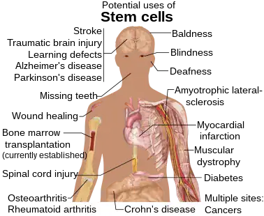 Áreas do corpo humano onde a aplicação da terapia com células-tronco é promissora.