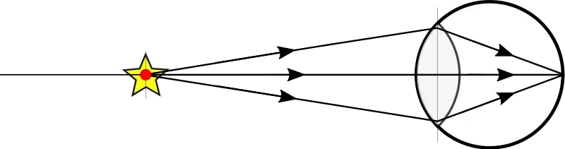 Ray drawing eye schematic.svg