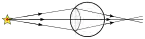 Ray drawing eye schematic02.svg